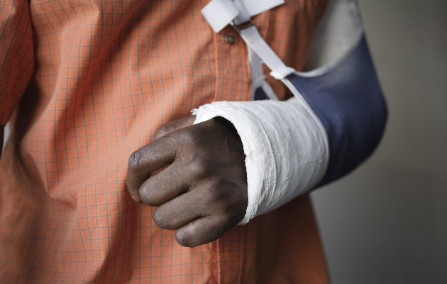 Closeup midsection of a man with broken arm in cast